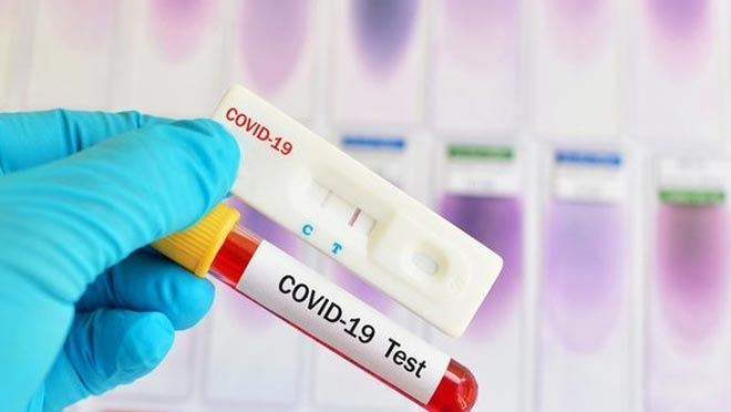 İL SAĞLIK MÜDÜRLÜĞÜ COVİD-19 PCR TEST YAPTIRANLARI UYARDI