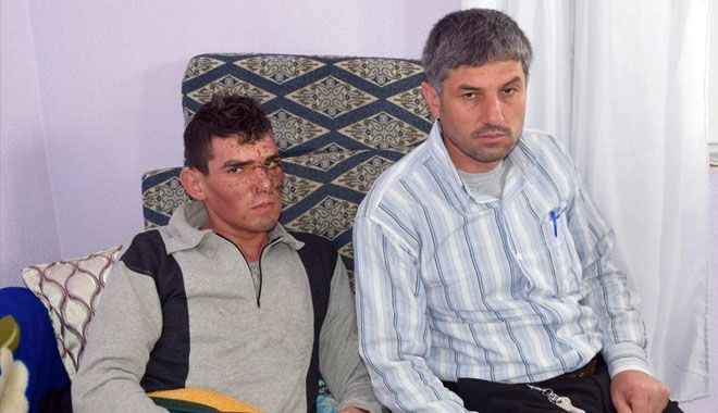 KAYSERİ PATLAMASINDA YARALANAN ASKER