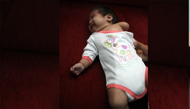 DOĞUŞTAN SOL KOLU OLMAYAN AYŞE SU BEBEK, YARDIM BEKLİYOR