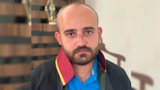 BOŞANMA DAVASINDA AVUKATA DARP