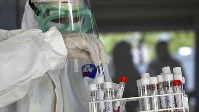 İL SAĞLIK MÜDÜRLÜĞÜ YETKİLİLERİ AÇIKLADI