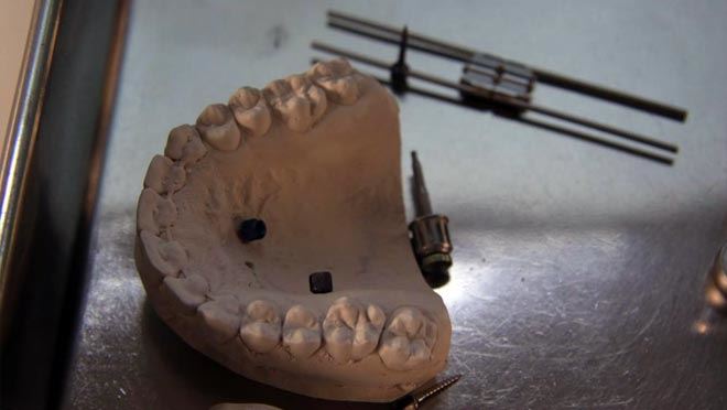 BU BULUŞ DİŞ HEKİMLERİNİN İŞİNİ KOLAYLAŞTIRACAK