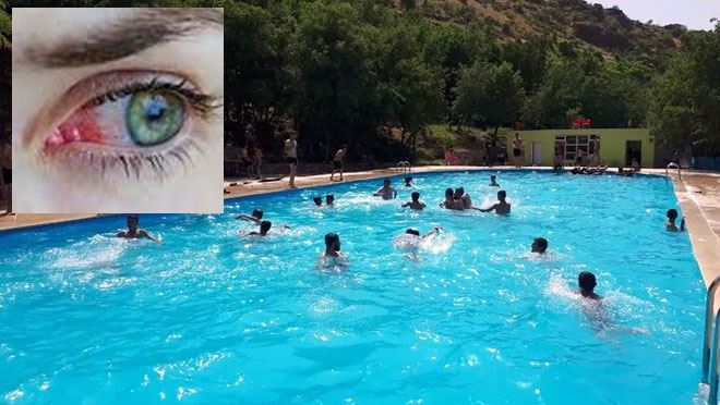 HAVUZ KEYFİNİZ GÖZE GELMESİN!