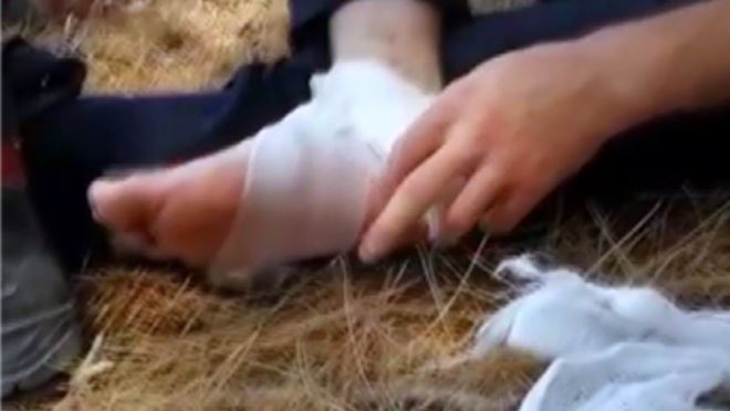 TEDAVİ ETTİKTEN SONRA ALEVLERE MÜDAHALEYE DEVAM ETTİ