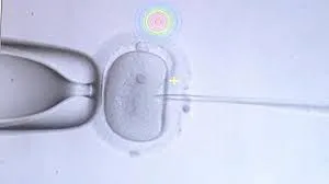 Erkeklerde kanser ve kısırlık riskine karşı sperm dondurma yöntemi