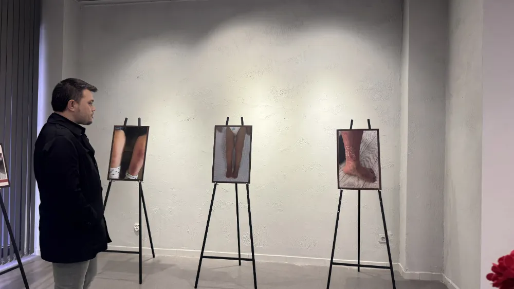 Romatizma hastalıklar yapay zeka ile görselleştirildi!