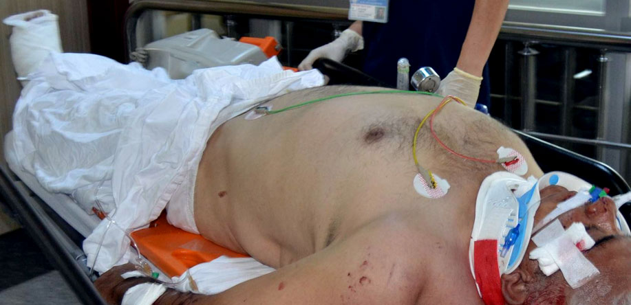 TRAFİK KAZASI: 1 YARALI