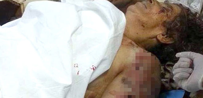 KÖPEKLERİN SALDIRISINA UĞRAYAN KADIN ÖLDÜ