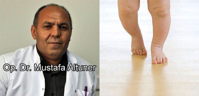 ÇOCUKLARDAKİ DİZ AĞRILARINI HAFİFE ALMAYIN