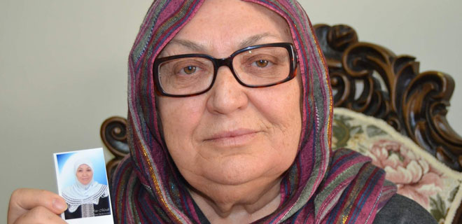 63 YAŞINDAKİ KADININ BOTOKS ÇİLESİ