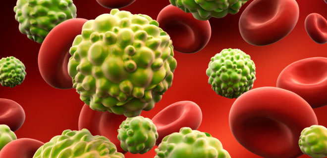 YILDA 170 BİN KİŞİYE KANSER TEŞHİSİ KONULUYOR